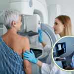 AI breast cancer diagnoses