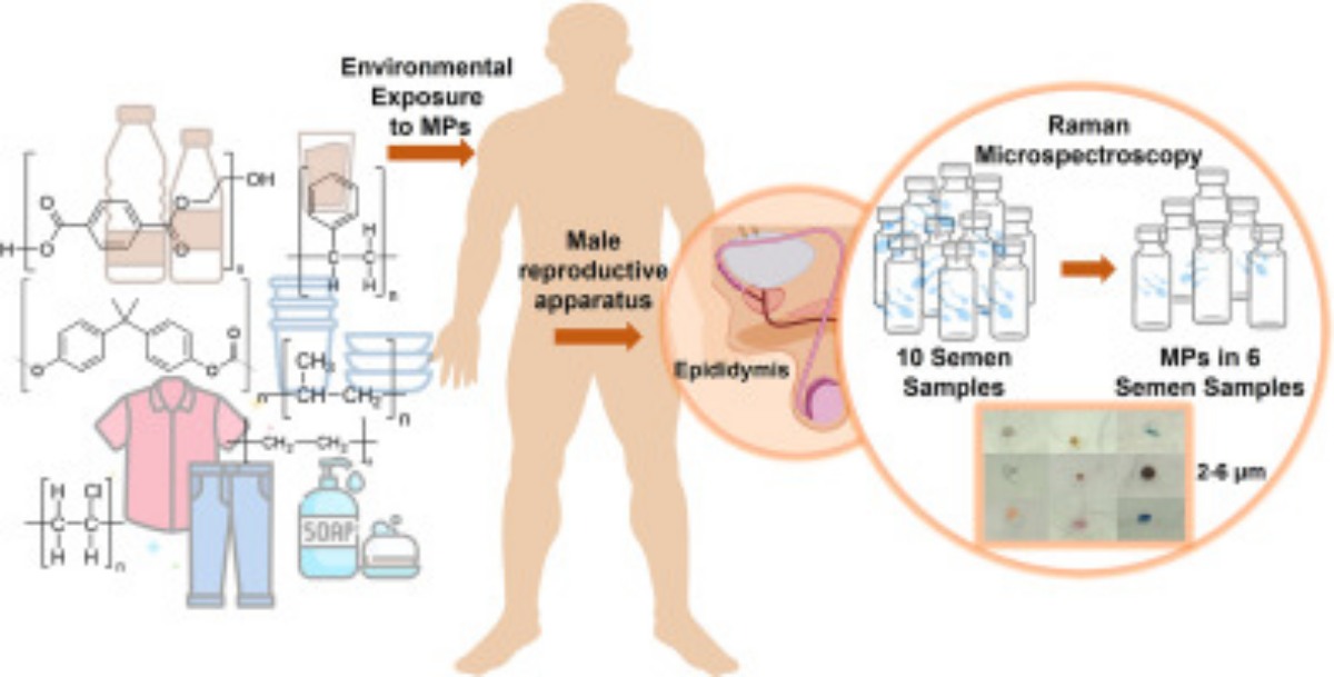 Microplastic found in human sperm