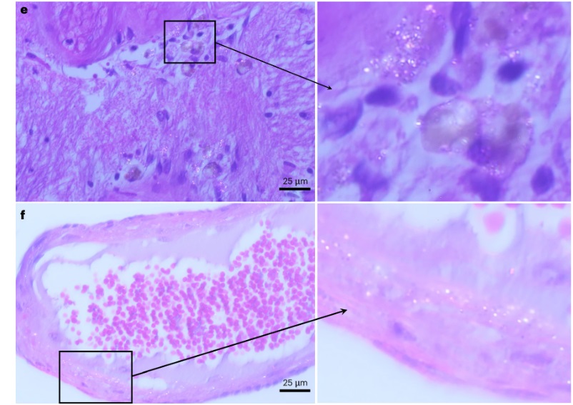 microplastics in the brain