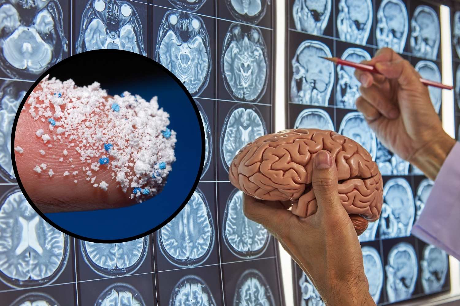 microplastics in the brain