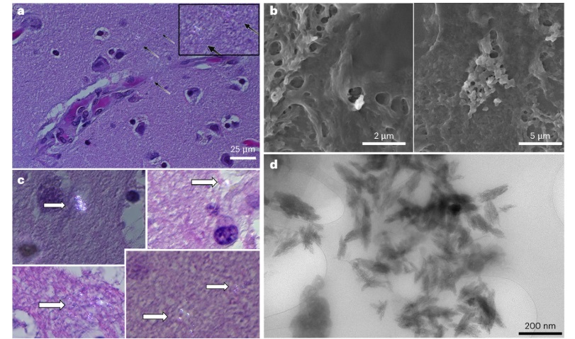 microplastics in the brain